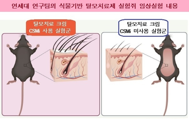연세대 탈모치료제