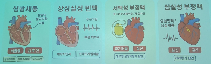 부정맥의 다양한 종류와 주요 증상들. 출처=대한부정맥학회 '2024 심방세동 팩트시트'