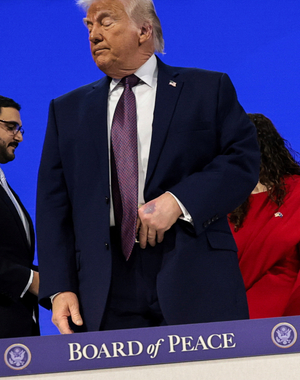 트럼프 손등에 멍자국, 또 ‘건강이상설’?…“테이블에 부딪혀”