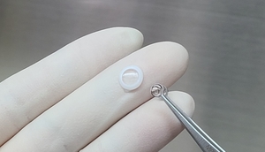 티이바이오스, 국내 최초 인공각막 임상 완료…각막 환자 ‘새 희망’