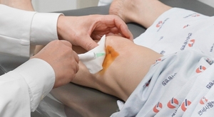 연세사랑병원, “중기 관절염 SVF 환자, 인공관절수술 대신 주사치료 먼저 고려하는 경향”