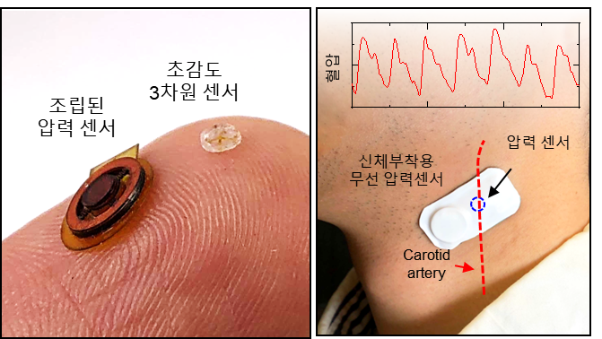 경희대