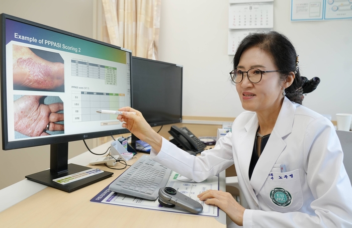 이대서울병원 노주영 교수가 무좀의 원인과 치료·예방 수칙에 대해 설명하고 있다. 사진=이대서울병원