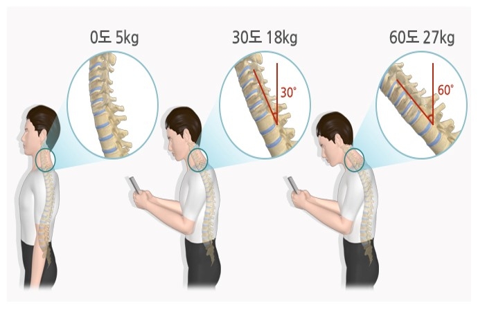 고개를 숙이는 각도에 따라 목 디스크에 걸리는 압박 정도. 출처=질병관리청 건강정보포털
