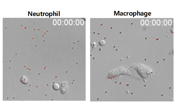 면역세포와 미세플라스틱의 상호작용