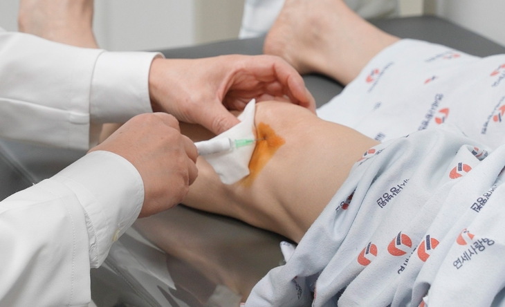 자가지방유래 기질혈관분획(SVF) 주사 치료