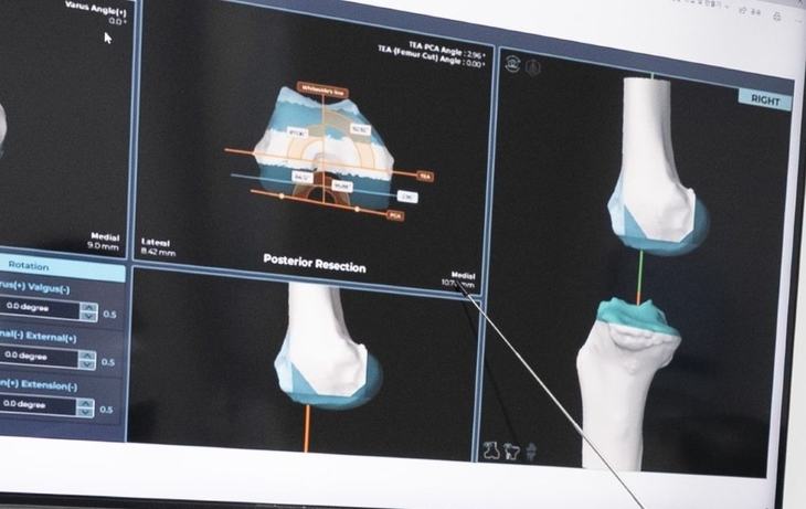 니비게이트는 환자의 CT, MRI 영상 등 해부학적 데이터를 수술 전에 AI 시스템으로 정밀 분석하는 기술이다.
