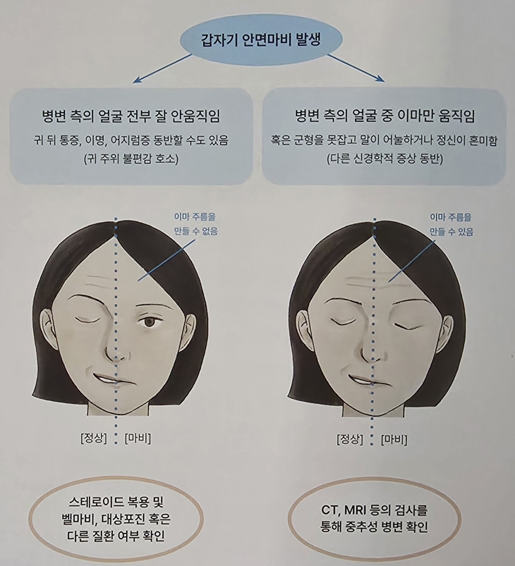말초성 안면신경 마비와 뇌졸중 같은 중추성 안면신경마비
