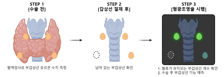 형광조영술 기반 로봇 갑상선 후 부갑상선 기능 예측법 개념도