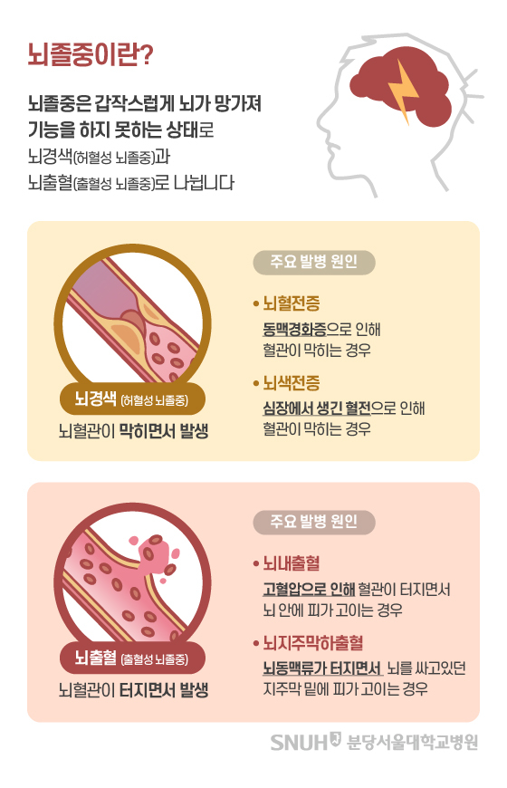 뇌졸중