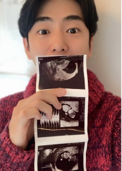 안용준·베니 부부 결혼 8년 만에 부모된다 "5월에 만나"