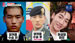 한영, 남편 박군 ‘쌍꺼풀+코’ 성형수술 폭로