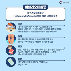 고양시 여름철 비브리오패혈증 예방수칙 제시