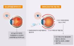 대웅테라퓨틱스, 세계 최초 ‘점안제형 당뇨망막병증 치료제