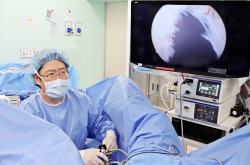 [헬스&에너지+] 전립선비대증, 약물치료로 안되면 