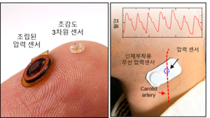 경희대, 심혈관 정보측정 고감도 무선 압력센서 개발