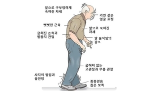 [건강e+ 삶의 질] 종종걸음·발끌림…‘부모님 걸음’에서 파킨슨병 보인다