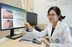 폭염·폭우에 습기찬 발, 무좀균이 좋아해…장화 패션 유행도 한몫