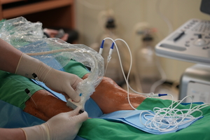 고주파 열치료술, 인공관절 수술 후 통증 ‘해결사’