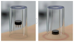 테라젝아시아-제이와이팜, 약물탑재 마이크로니들 패치 상용화 협력