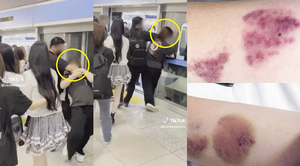 연예인 입출국 인파 운집 ‘공항 마비’ 없앤다