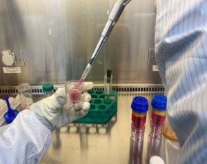 SVF 주사치료, 고령층 무릎 퇴행성관절염 환자에도 유용