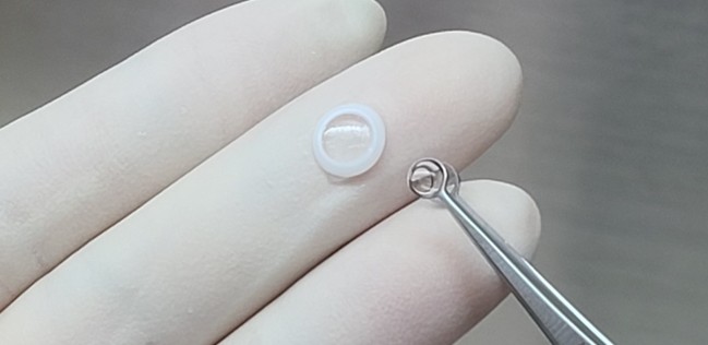 티이바이오스, 국내 최초 인공각막 임상 완료…각막 환자 ‘새 희망’